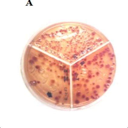 Pure Culture Of Yersinia Ruckeri On Yersinia Selective Agar Cin Agar