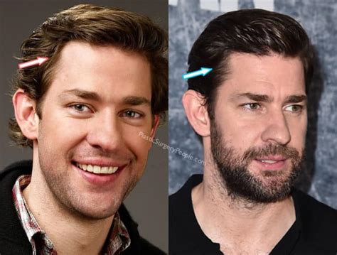 John Krasinski Did NOT Have Nose Job and Here's Proof