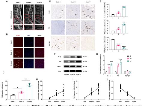 Figure 1 From Strontium Ranelate Ameliorates Intervertebral Disc