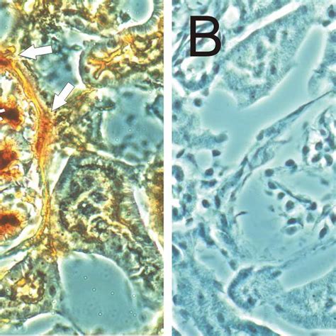 Enzyme histochemical staining of kidney sections of... | Download Scientific Diagram