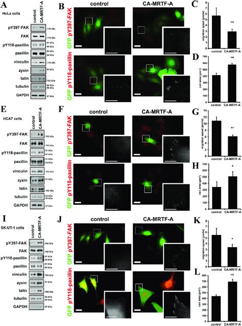 Ca Mrtf A Induces The Phosphorylation Of Fak And Paxillin Also In