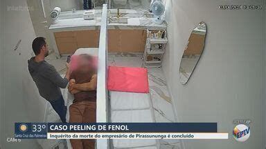 Jornal Da Eptv Edi O S O Carlos Araraquara Caso Do Peeling De