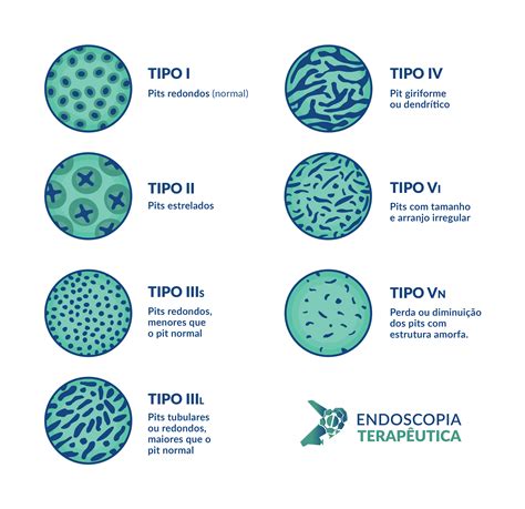 Classificação De Kudo Pit Pattern Endoscopia Terapeutica