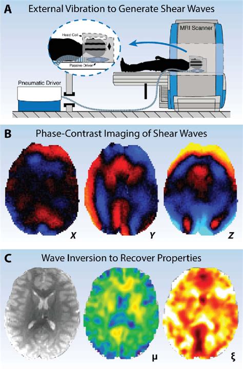 Figure From Magnetic Resonance Elastography For Examining