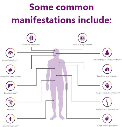 Disease Overview | Healthcare Professionals