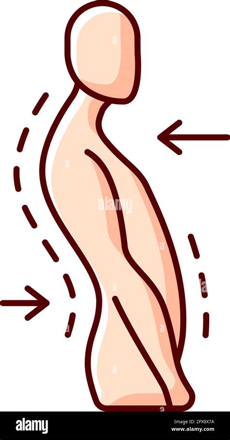 Swayback Posture Rgb Color Icon Stock Vector Image And Art Alamy