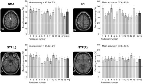 Results Of The Whole Brain Searchlight MVPA Searchlight Analysis