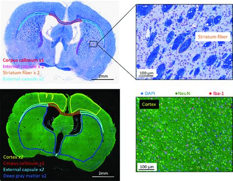 Typical Histological Sections Of A Poly I C Rat Brain Stained With