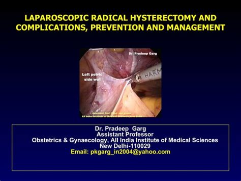 Laparoscopic Radical Hysterectomy For Carcinoma Cervix Female Pelvic