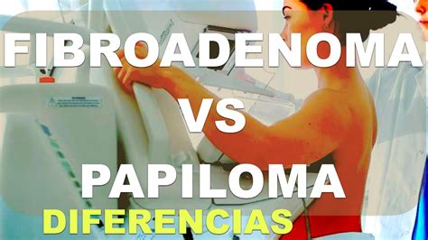 Diferencias Entre Fibroadenoma Y Papiloma Intracanalicular Lesiones