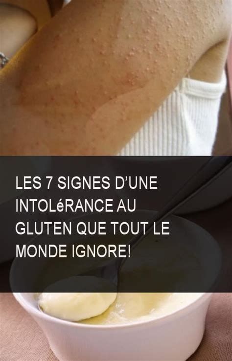 Les Signes Dune Intol Rance Au Gluten Que Tout Le Monde Ignore