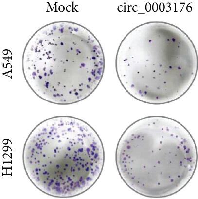 Hsa Circ 0003176 Suppressed The Proliferation Migration And Invasion