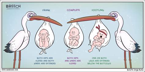 NREMT-B: Breech - Medcomic