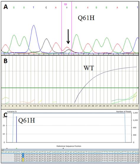 Example Of Molecular Results In A Kras Exon Mutated Sample Case