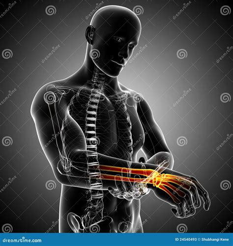 Hand Pain Line And Solid Icon, Officesyndrome Concept, Hand Pain Vector