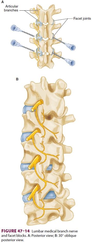 cervical thoracic lumbar medial branch blocks