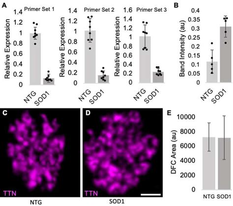 Figure From Titin Is A Nucleolar Protein In Neurons Semantic Scholar