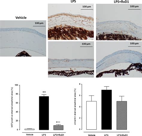 Ki Marker Of Undifferentiated Fibroblast Into The Cornea Was