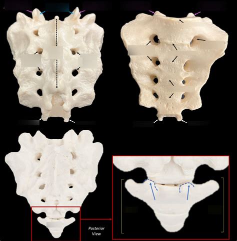 Lab 2 Sacrum And Coccyx Diagram Quizlet