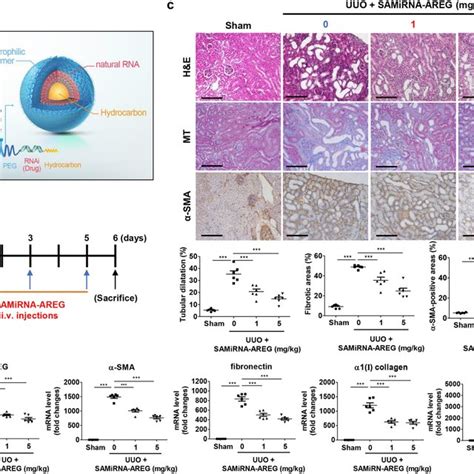 Establishment Of UUO Induced Mice And Kinetic Analysis Of AREG