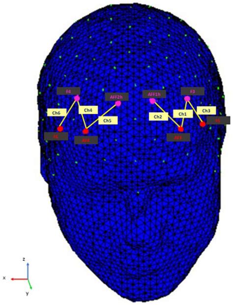 Brain Sciences | Free Full-Text | ADV at the Time of COVID-19 Brain