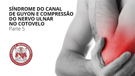 Síndrome do Canal de Guyon e Compressão do Nervo Ulnar no Cotovelo