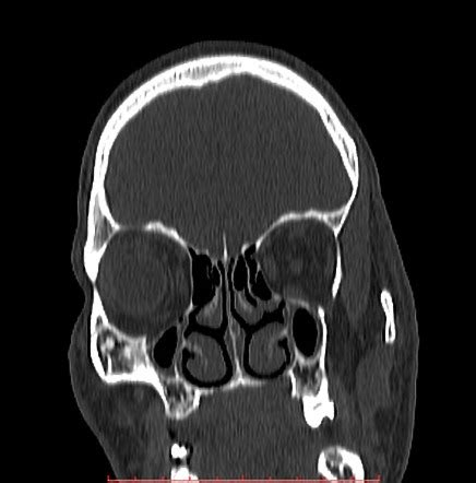 Image Radiopaedia Org