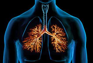 Gejala Bronkitis Penyebab Dan Cara Pencegahan Bronchitis