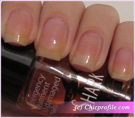 Kinetics Nano Shark Emergency Treatment for damaged nails - Review ...