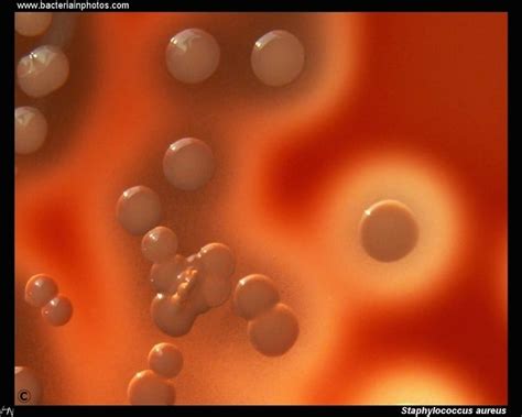 Staphylococcus Aureus An Overview Microbe Notes