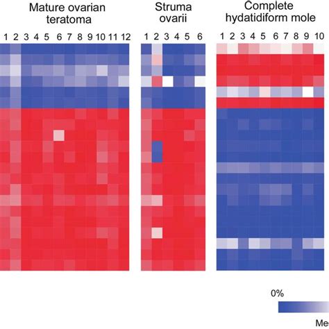 Methylation Status Of Imprinting Control Regions Icrs Of Imprinted