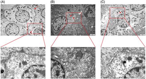 Tce Sensitization Induced Renal Tubular Epithelial Cell Damage In Mice