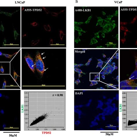 Double Immunofluorescence Showing Colocalization Of Tpd52 And Lkb1 A Download Scientific