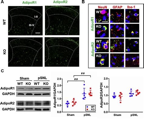 Adiponectin Regulates Thermal Nociception In A Mouse Model Of