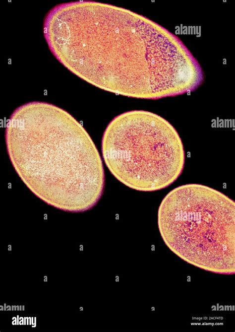 La Bacteria Clostridium Difficile Color Micrografía De Electrones De