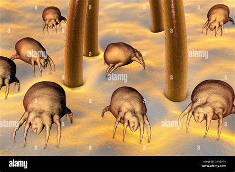 Dust Mites Dermatophagoides Pteronyssinus On Human Skin Computer