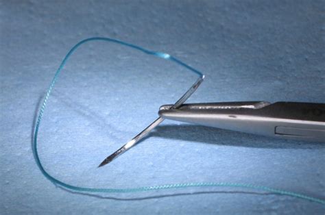 Types of Surgical Staples Used Internally | Livestrong.com