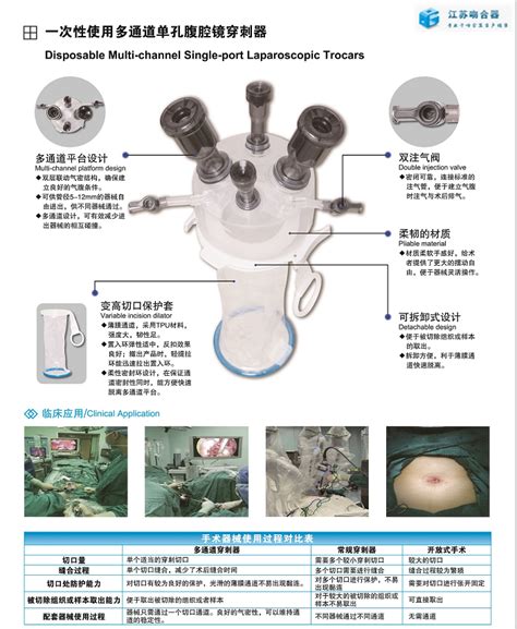 一次性使用多通道单孔腹腔镜穿刺器腔镜镜穿刺器吻合器消化道吻合器肛肠吻合器一次性吻合器吻合器厂家