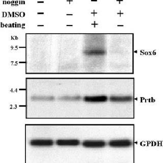 Northern Blot Analysis Of Sox Prtb And Sox Expression In P Cl