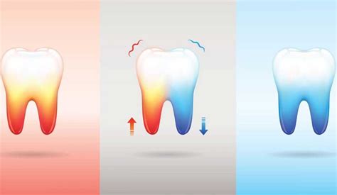 Sudden Teeth Cold Sensitivity