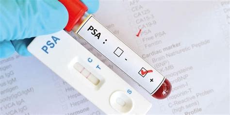 PSA Test Prostata Specifični Antigen Hightop Odemshop