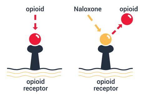 About Naloxone (Narcan™) - Overdose Lifeline