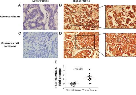 Figure 1 From The Prognostic Significance Of Fibroblast Growth Factor