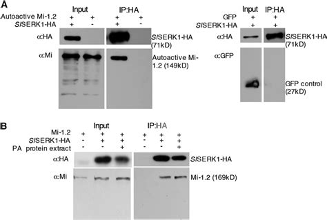 Figure From The Conformation Of A Plasma Membrane Localized Somatic