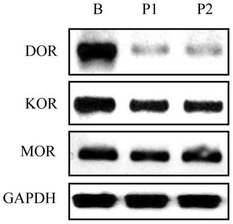 Opiate Receptors Are Expressed In Human Podocytes Total Rnas Were