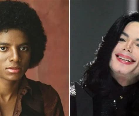 Notícias Por que a pele de Michael Jackson ficou branca quando ele