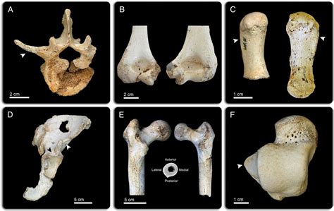 Postcranial Morphology Of The Middle Pleistocene Humans From Sima De