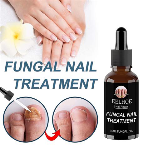 Fungal Nail Treatment Essence Feet Care Repair Foot Toe Nails Fungus