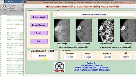 Breast Cancer Detection Classification Using Neural Network Matlab