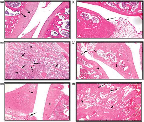 A Histopathology Photomicrograph Of Knee Joint Of Control Rat Showing